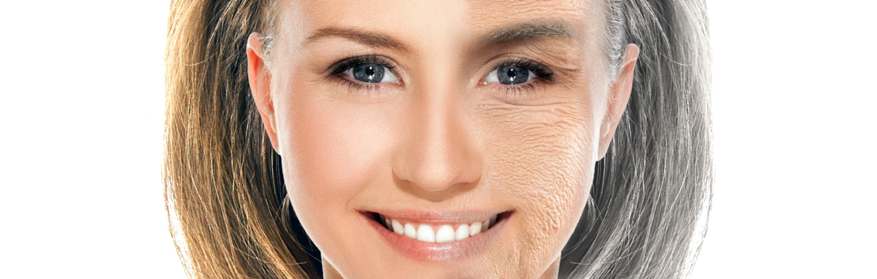 woman before and after